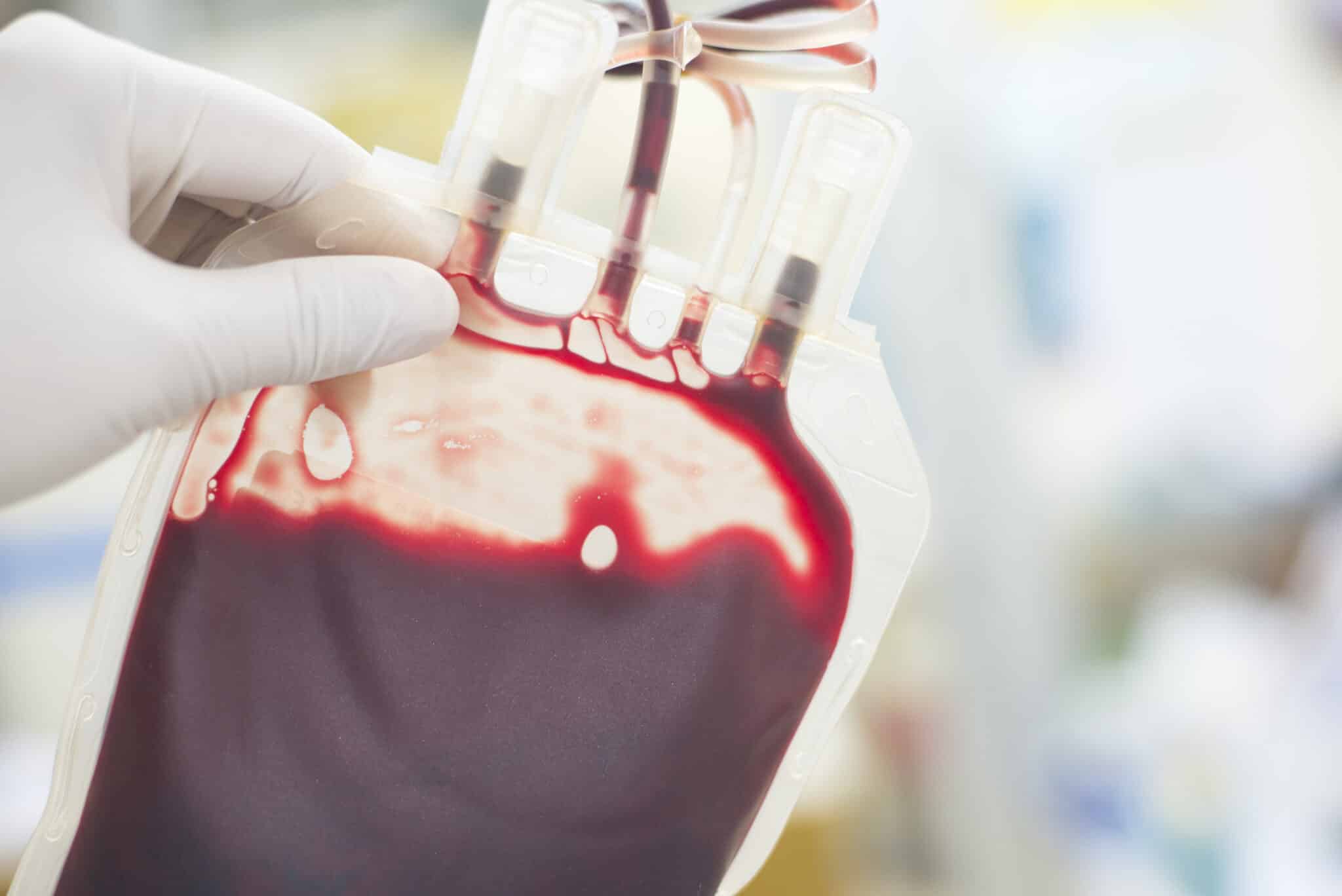 Prise en compte des arboviroses dans la sécurité transfusionnelle