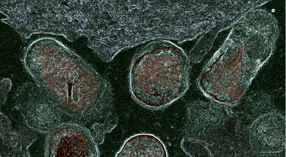 photo au microscope de bactéries attaquant les cellules du vagin