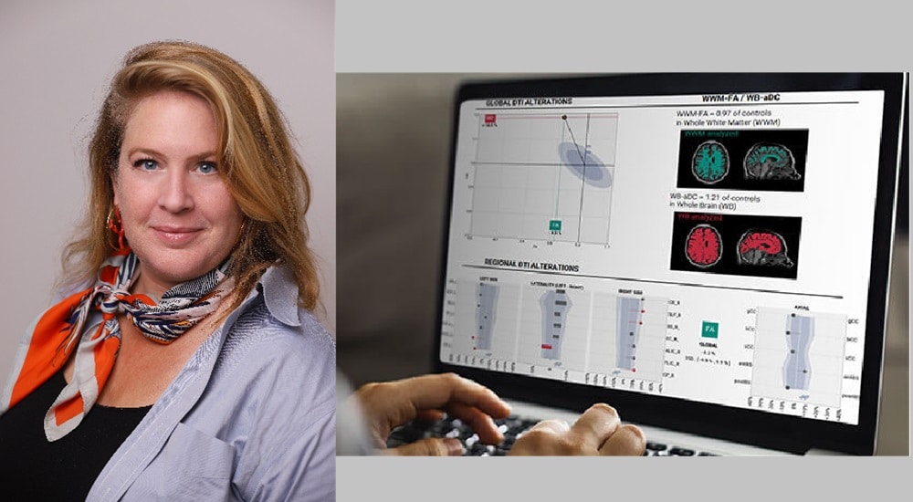 Maladie de Parkinson : un biomarqueur numérique non invasif pourrait favoriser le diagnostic différentiel