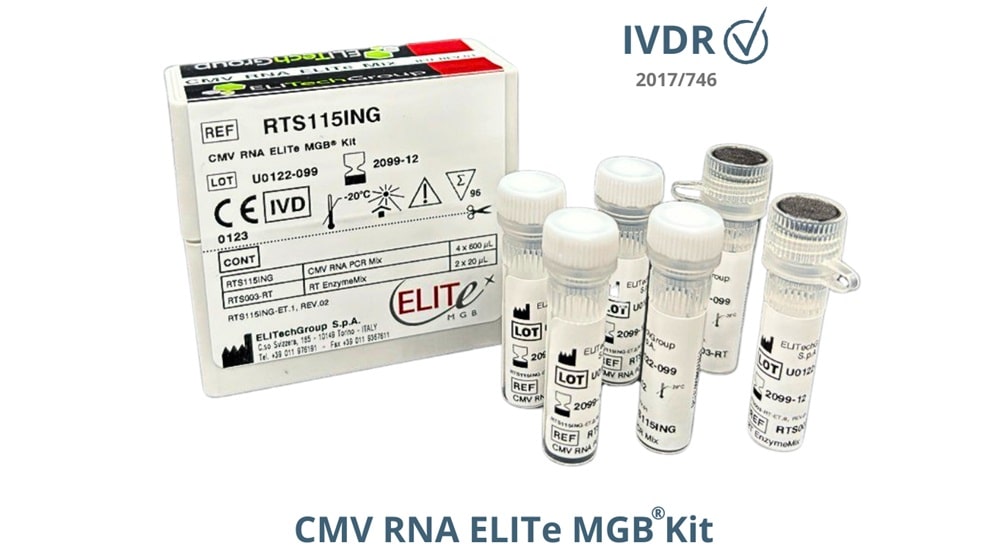 Le kit CMV RNA d'ELITech